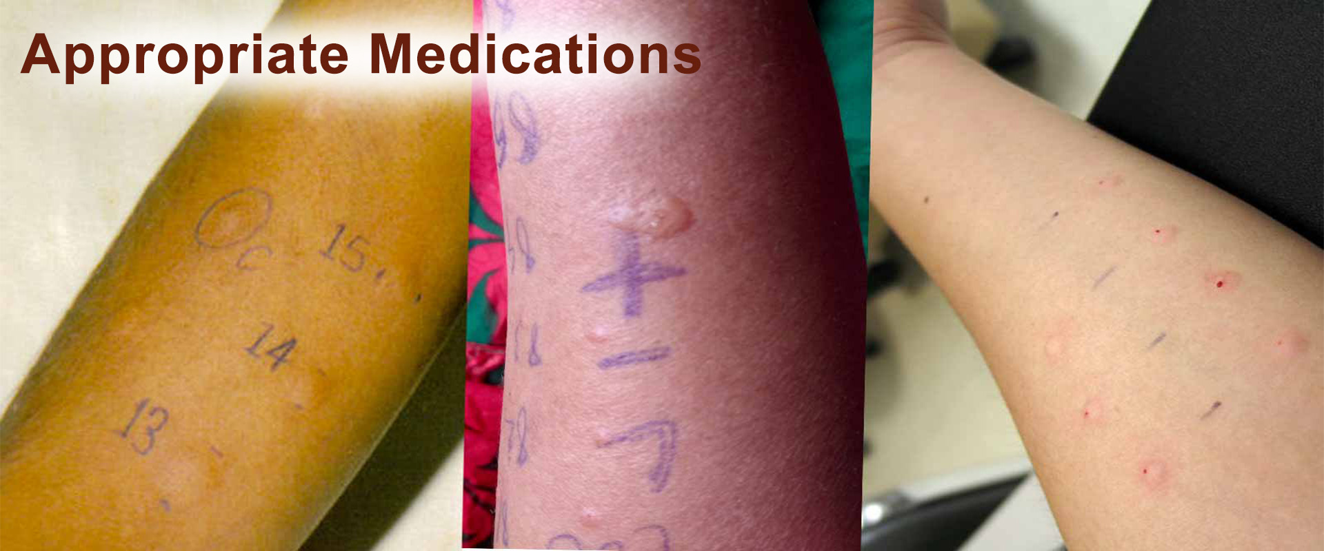 allergy-image-2