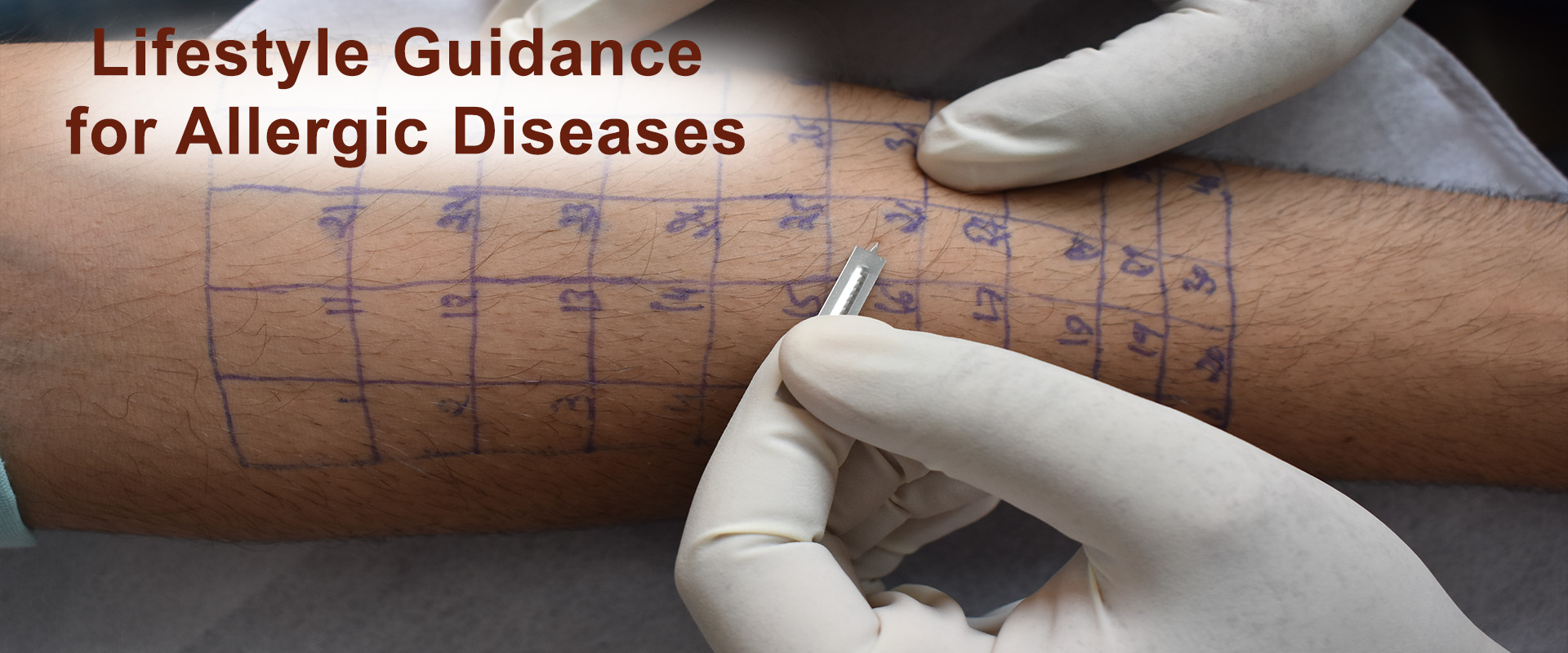 allergy-image-2